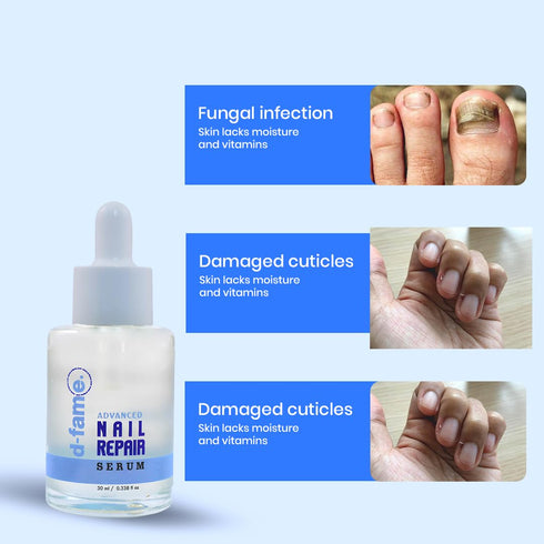 D-Fame Advanced Nail Repair Serum